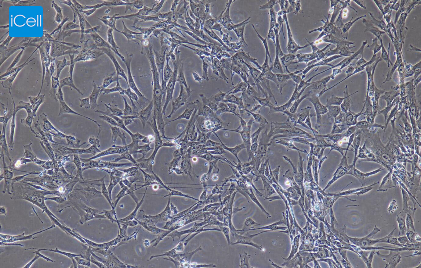 胎盘绒毛膜滋养层细胞
