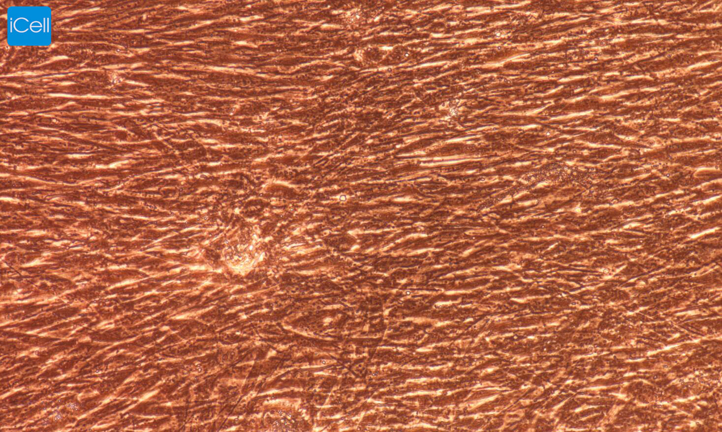 脉络膜成纤维细胞