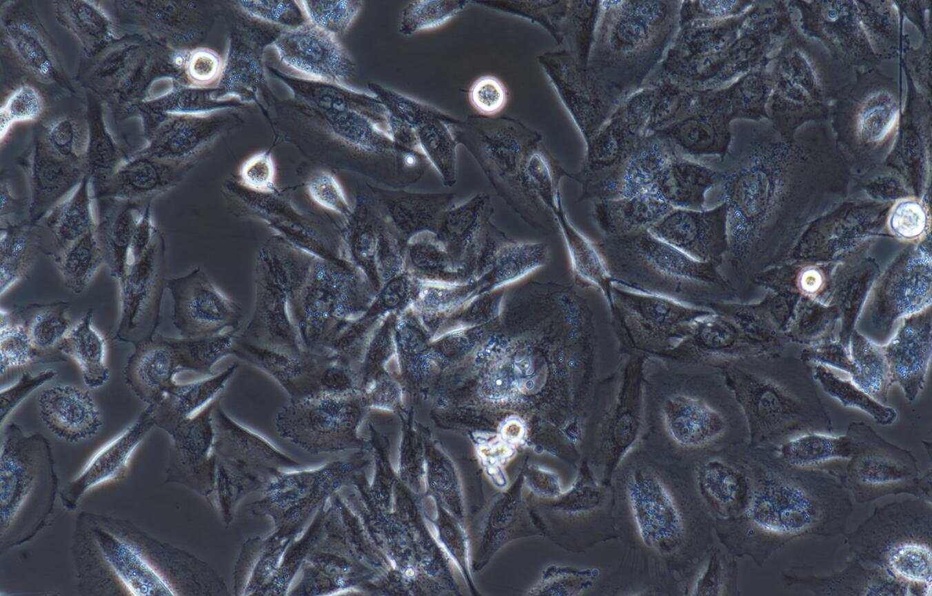 ncih1975人肺腺癌细胞