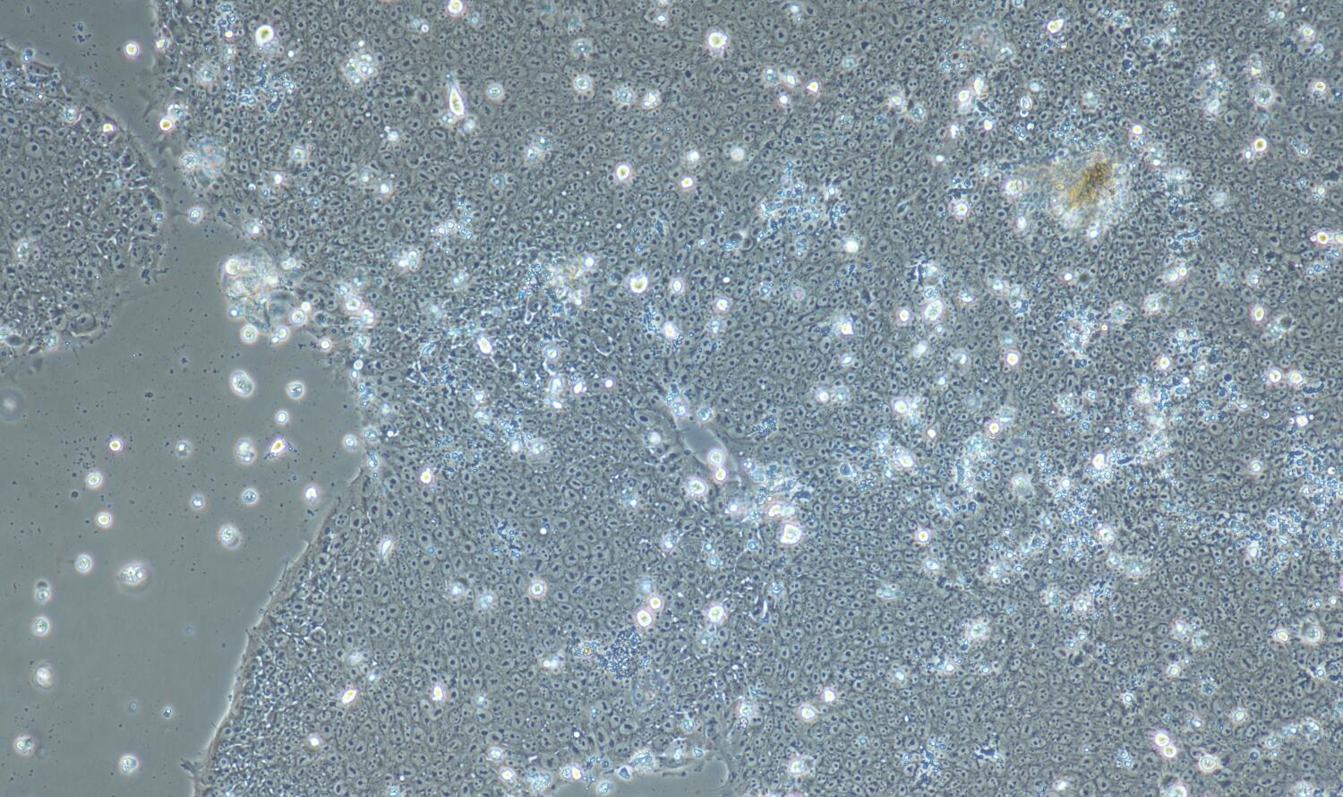 ips细胞                      ips cells