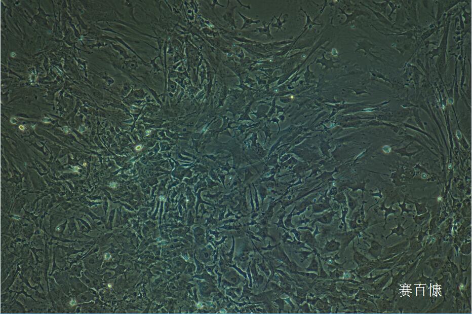 肝星状细胞