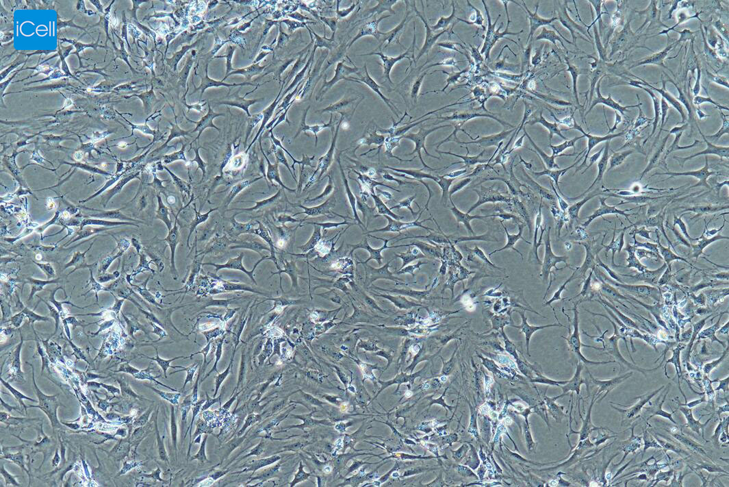类风湿关节炎滑膜成纤维细胞