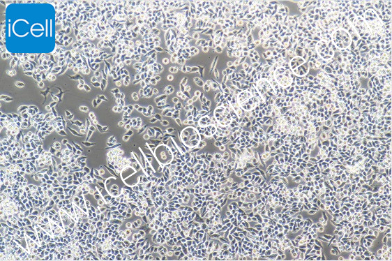 RKO 人结肠腺癌细胞-原代细胞-STR细胞-细胞培养基-镜像绮点生物