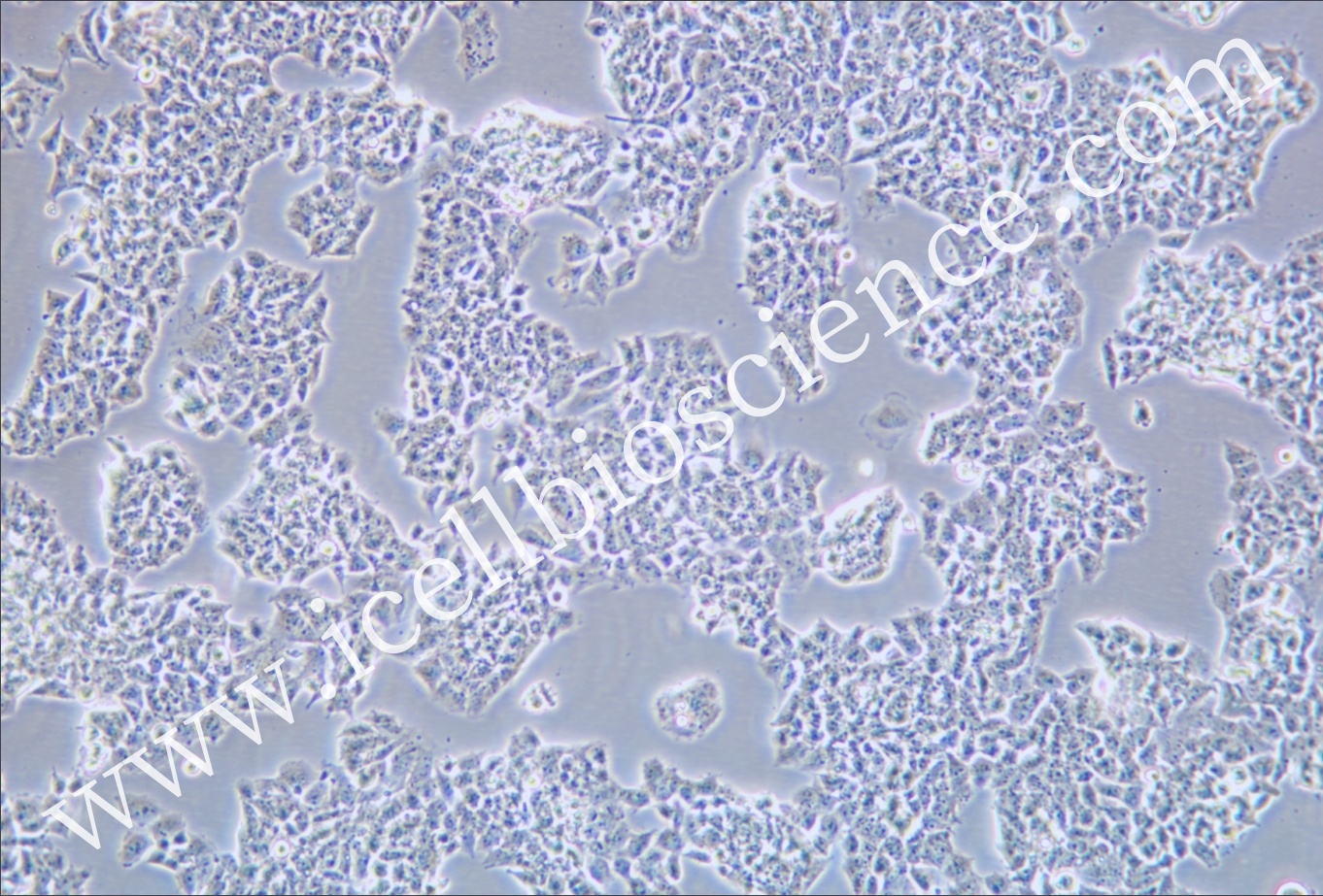 NCI-H69AR 人肺癌细胞-原代细胞-STR细胞-细胞培养基-镜像绮点生物