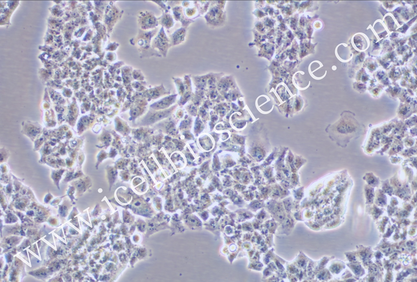 NCI-H69AR 人肺癌细胞-原代细胞-STR细胞-细胞培养基-镜像绮点生物