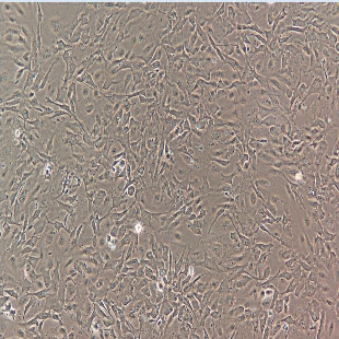 人原代肝窦内皮细胞