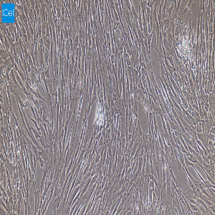 大鼠原代髓核细胞