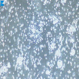 小肠隐窝上皮细胞