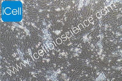 视网膜muller细胞