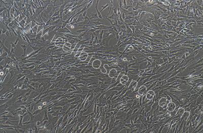 人子宫内膜基质细胞